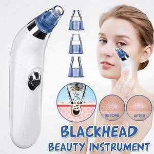 ✨Crispy 4 in 1 Multi-Function Blackhead Whitehead Extractor Remover Device