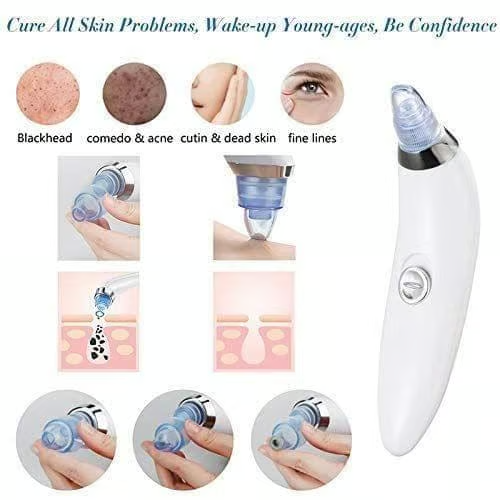 ✨Crispy 4 in 1 Multi-Function Blackhead Whitehead Extractor Remover Device