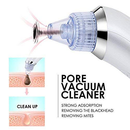 ✨Crispy 4 in 1 Multi-Function Blackhead Whitehead Extractor Remover Device